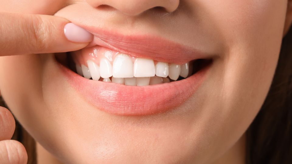 Sangrado de encÃ­as | clÃ­nica dental sevilla