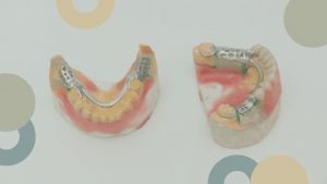 prÃ³tesis dentales | ClÃ­nica Dental SÃ¡nchez SolÃ­s