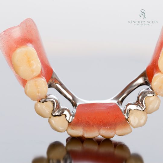 prótesis dentales sevilla | Clínica Dental
