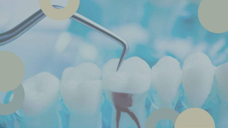 PorquÃ© se hace una endodoncia | ClÃ­nica SÃ¡nchez SolÃ­s | Sevilla