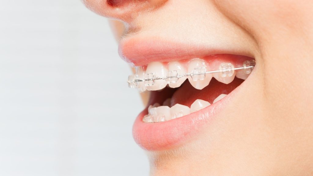 Tratamiento MaloclusiÃ³n Dental | SÃ¡nchez SolÃ­s Dentista