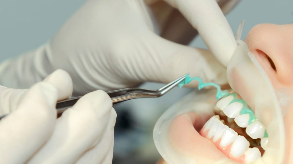 Blanqueamiento dental profesional | Dr Sánchez Solís