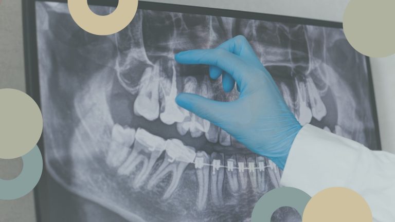 RadiografÃ­a Dental | S. SolÃ­s Dentista