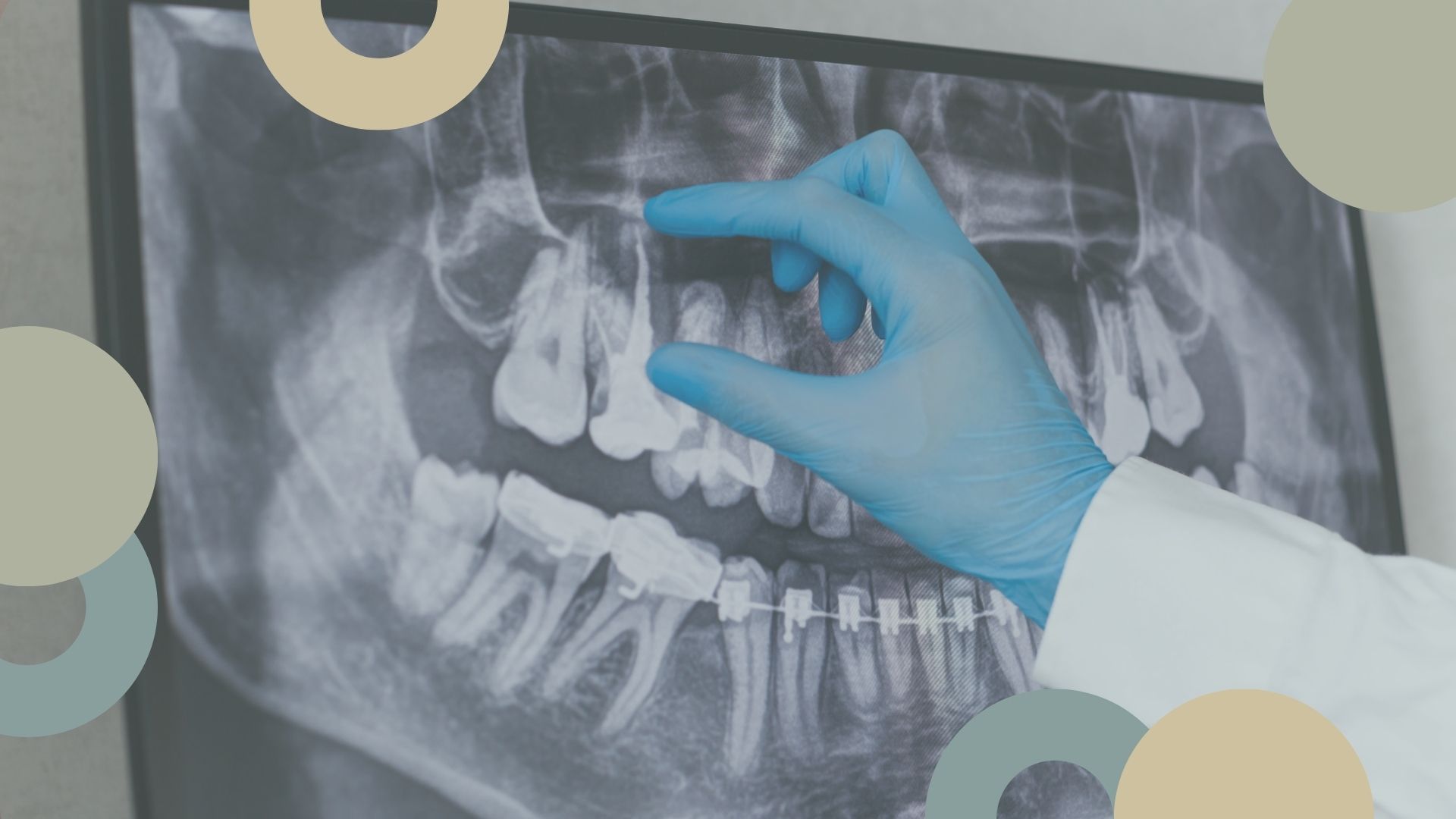 Radiografía Dental | S. Solís Dentista