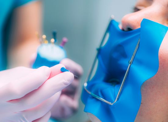 Prevención Endodoncia | Sánchez Solís Dentista
