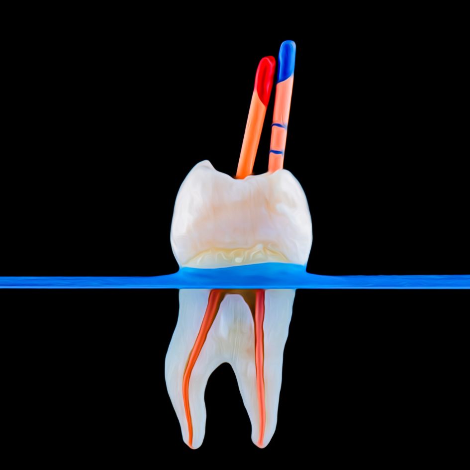 prevención endodoncia | sevilla este
