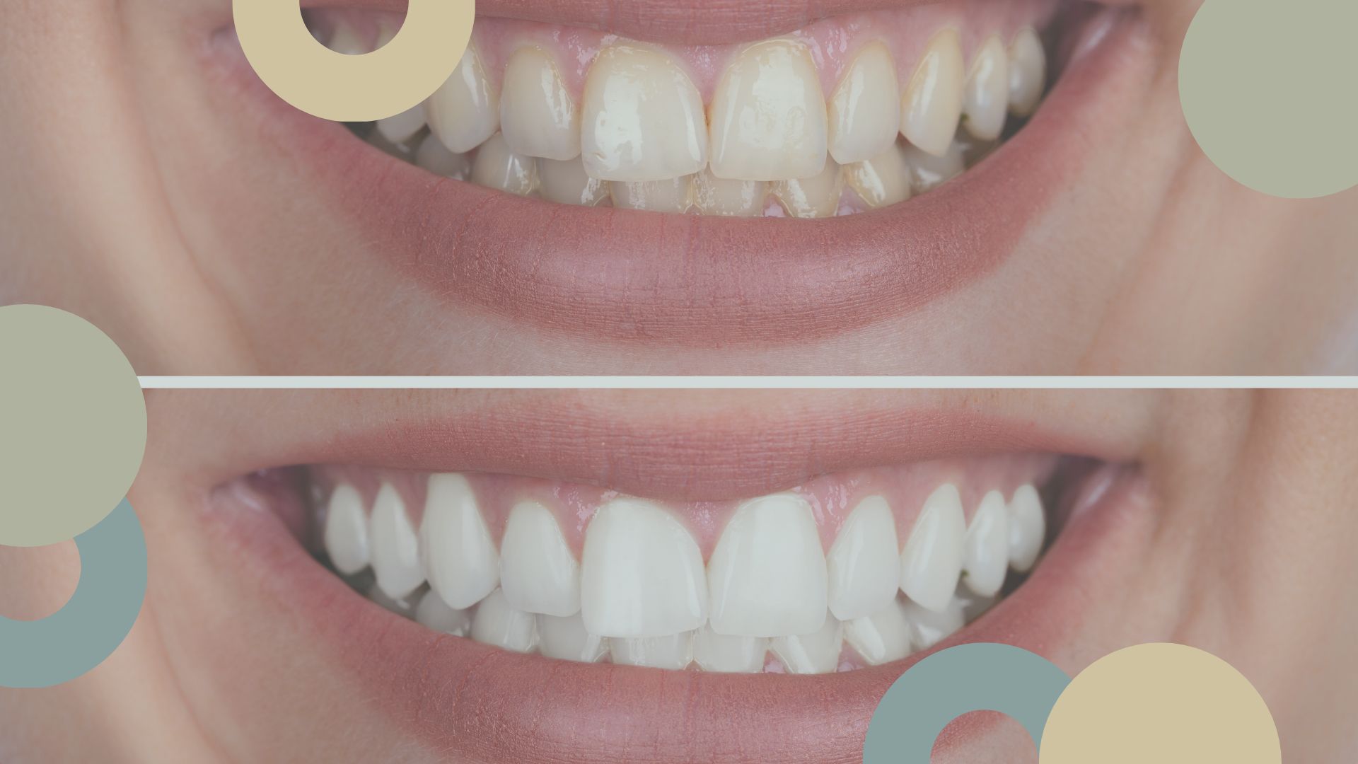 Estética Dental | Clínica Sánchez Solís | Sevilla Este