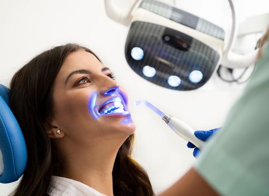 blanqueamiento dental Estética | Sevilla Este
