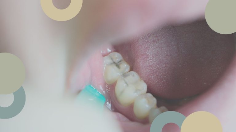Caries infantil | Clínica Dental | Sevilla Este