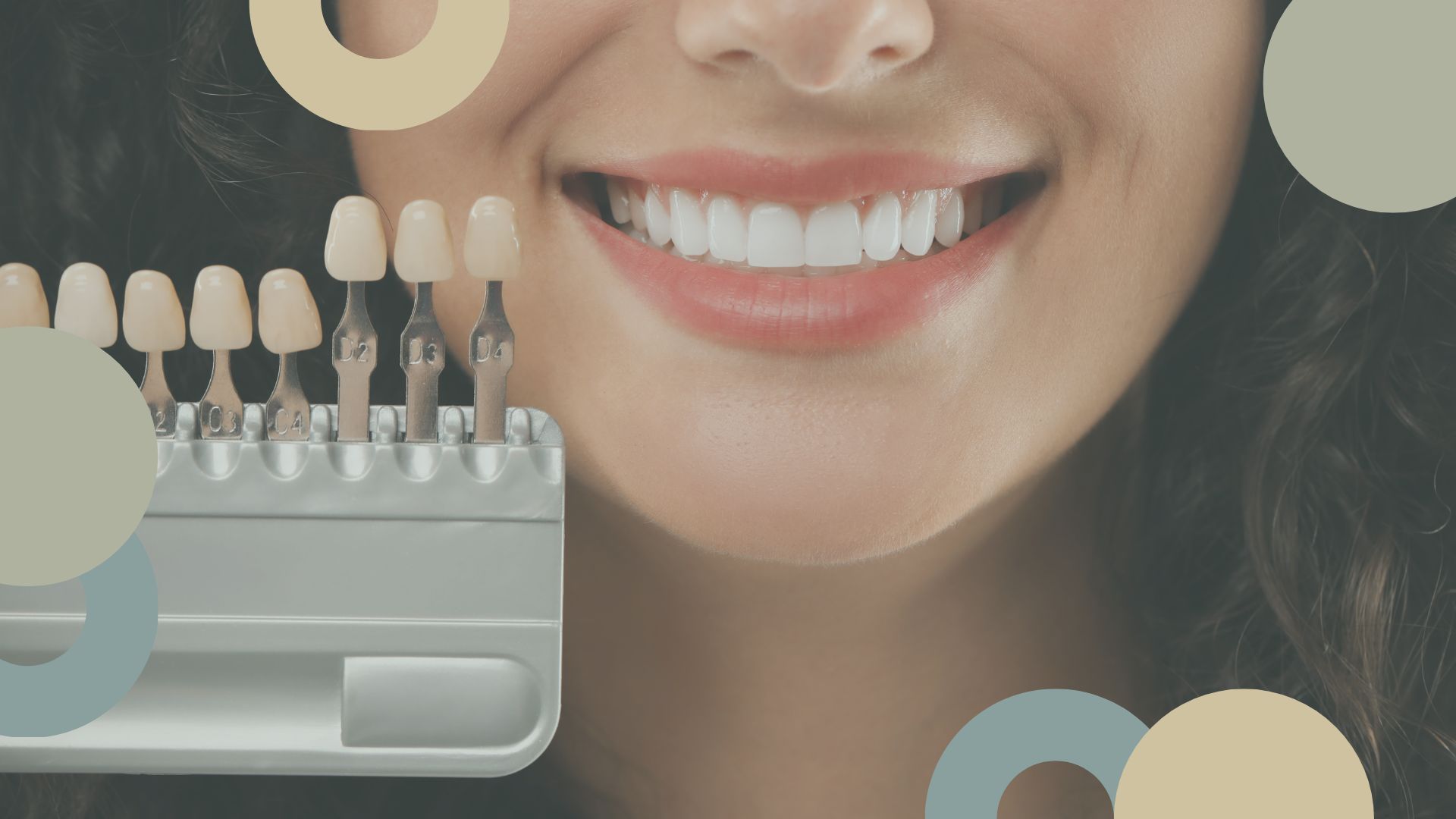 Estética dental sin tratamientos invasivos | Sevilla Este
