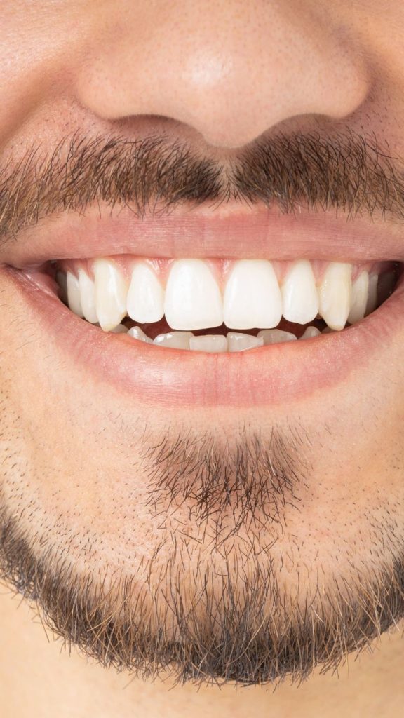 Sonrisa más estética | Sevilla Este